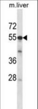 Mouse Adck2 Antibody western blot of mouse liver tissue lysates (35 ug/lane). The Adck2 antibody detected the Adck2 protein (arrow).