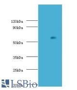 Western blot of Uncharacterized aarF domain-containing protein kinase 2 antibody at 2 ug/ml with K562 whole cell lysate. Secondary: Goat polyclonal to Rabbit IgG at 1:15000 dilution. Predicted band size: 69 KDa. Observed band size: 69 KDa.