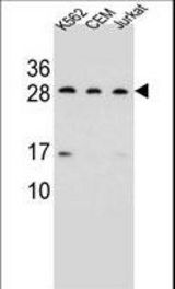 CD79A Antibody western blot of K562,CEM,Jurkat cell line lysates (35 ug/lane). The CD79A antibody detected the CD79A protein (arrow).