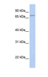 721_B cell lysate. Antibody concentration: 1.0 ug/ml. Gel concentration: 12%.