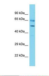 Western blot of Human Thymus Tumor. ADCK3 antibody dilution 1.0 ug/ml.