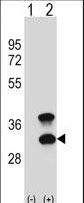 Western blot of CD79B (arrow) using rabbit polyclonal CD79B Antibody. 293 cell lysates (2 ug/lane) either nontransfected (Lane 1) or transiently transfected (Lane 2) with the CD79B gene.