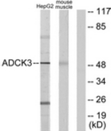 Western blot of extracts from HepG2/mouse muscle cells, using ADCK3 Antibody. The lane on the right is treated with the synthesized peptide.
