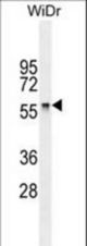 CABC1 antibody western blot of Widr cell line lysates (35 ug/lane). The CABC1 antibody detected the CABC1 protein (arrow).