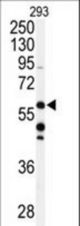 Western blot of anti-CABC1 Antibody (C-term D531) in 293 cell line lysates (35 ug/lane). CABC1 (arrow) was detected using the purified antibody.