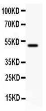 CD80 antibody Western blot. All lanes: Anti CD80 at 0.5 ug/ml. WB: Rat Thymus Tissue Lysate at 50 ug. Predicted band size: 34 kD. Observed band size: 50 kD.