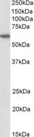 CD80 antibody (1 ug/ml) staining of Lymph Node lysate (35 ug protein/ml in RIPA buffer). Primary incubation was 1 hour. Detected by chemiluminescence.