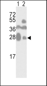 Western blot of CD81 Antibody in mouse kidney(lane 1) and cerebellum(lane 2) tissue lysates (35 ug/lane). CD81 (arrow) was detected using the purified antibody.