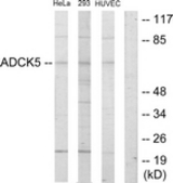 Western blot of extracts from HeLa/293/HUVEC cells, using ADCK5 Antibody. The lane on the right is treated with the synthesized peptide.
