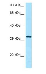 CD84 antibody Western Blot of Fetal Kidney.