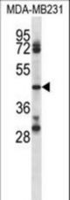 CD84 Antibody western blot of MDA-MB231 cell line lysates (35 ug/lane). The CD84 antibody detected the CD84 protein (arrow).