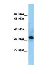 CD86 antibody LS-C146236 Western blot of COL0205 Cell lysate. Antibody concentration 1 ug/ml.