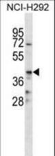 CD86 Antibody western blot of NCI-H292 cell line lysates (35 ug/lane). The CD86 antibody detected the CD86 protein (arrow).