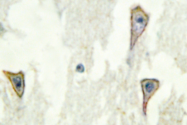IHC of A Cyclase I (D252) pAb in paraffin-embedded human brain tissue.