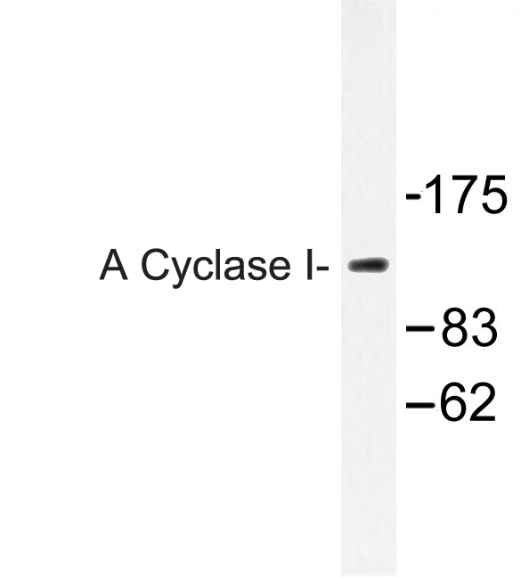 Western blot of A Cyclase I (D252) pAb in extracts from COLO205 cells.