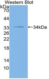 Western blot of recombinant ADCY1 / Adenylate Cyclase 1.