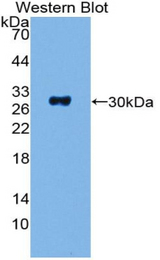 Western blot of recombinant ADCY1 / Adenylate Cyclase 1.