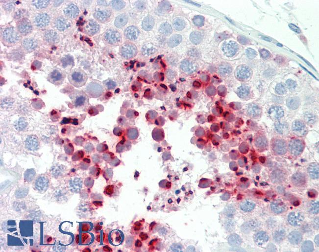Huma Testis: Formalin-Fixed, Paraffin-Embedded (FFPE)