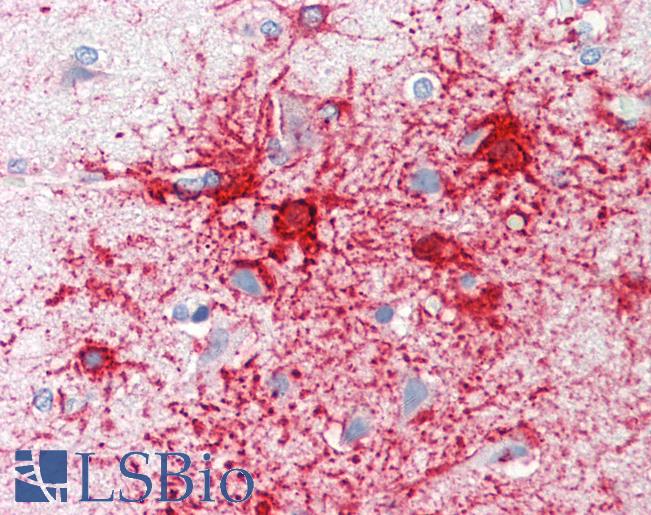 Anti-ADCY1 / Adenylate Cyclase 1 antibody IHC staining of human brain, cortex. Immunohistochemistry of formalin-fixed, paraffin-embedded tissue after heat-induced antigen retrieval. Antibody LS-B10007 concentration 10 ug/ml.