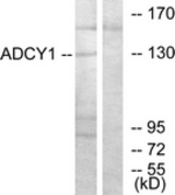 Western blot of extracts from COLO205 cells, using ADCY1 Antibody. The lane on the right is treated with the synthesized peptide.