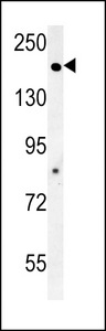 ADCY10 Antibody western blot of K562 cell line lysates (35 ug/lane). The ADCY10 antibody detected the ADCY10 protein (arrow).