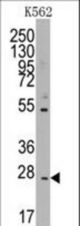 Western blot of anti-CD8B1 antibody in K562 cell line lysates (35 ug/lane). CD8B1(arrow) was detected using the purified antibody.