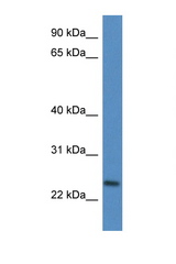 CD9 antibody LS-C135937 Western blot of Fetal Heart lysate. Antibody concentration 1 ug/ml.