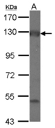 Sample (30 ug of whole cell lysate) A: IMR32 7.5% SDS PAGE ADCY2 antibody diluted at 1:1000