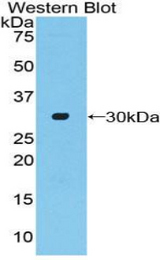 Western blot of recombinant ADCY2 / Adenylate Cyclase 2.