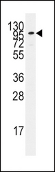 Western blot of anti-ADCY2 antibody in Jurkat cell line lysates (35 ug/lane). ADCY2(arrow) was detected using the purified antibody.