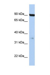 FAS / CD95 antibody LS-C109570 Western blot of Jurkat Cell lysate. Antibody concentration 1 ug/ml.