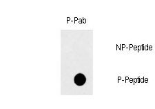 Dot blot of Phospho-FAS-Y291 polyclonal antibody on nitrocellulose membrane. 50ng of Phospho-peptide or Non Phospho-peptide per dot were adsorbed. Antibody working concentration was 0.5ug per ml. P-antibody: phospho-antibody; P-Peptide: phospho-peptide; NP-Peptide: non-phospho-peptide.