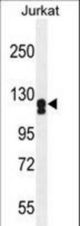 ADCY2 Antibody western blot of Jurkat cell line lysates (35 ug/lane). The ADCY2 antibody detected the ADCY2 protein (arrow).