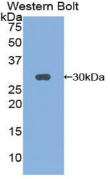 Western blot of recombinant ADCY3 / Adenylate Cyclase 3.