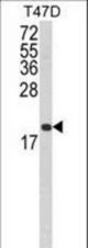 Western blot of FAS Antibody in T47D cell line lysates (35 ug/lane). FAS (arrow) was detected using the purified antibody.