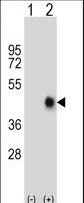 Western blot of FAS (arrow) using rabbit polyclonal FAS Antibody. 293 cell lysates (2 ug/lane) either nontransfected (Lane 1) or transiently transfected (Lane 2) with the FAS gene.