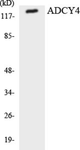 Western blot of the lysates from 293 cells using ADCY4 antibody.