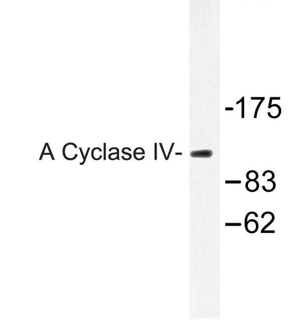 Western blot of A Cyclase IV (L226) pAb in extracts from Jurkat cells.