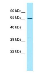 CD96 antibody Western Blot of HeLa.