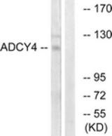 Western blot of extracts from Jurkat cells, using ADCY4 Antibody. The lane on the right is treated with the synthesized peptide.