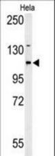 Western blot of ADCY4 Antibody in HeLa cell line lysates (35 ug/lane). ADCY4 (arrow) was detected using the purified antibody.