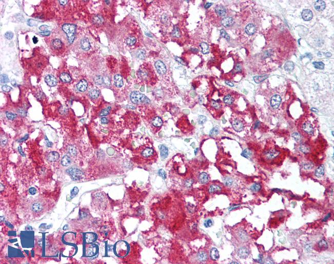 Anti-CD98 antibody IHC of human adrenal medulla. Immunohistochemistry of formalin-fixed, paraffin-embedded tissue after heat-induced antigen retrieval. Antibody LS-B646 concentration 5 ug/ml.