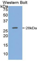 Western blot of recombinant ADCY5 / Adenylate Cyclase 5.