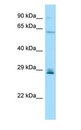 CD99L2 antibody Western Blot of HeLa.