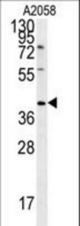 CD99L2 Antibody western blot of A2058 cell line lysates (35 ug/lane). The CD99L2 antibody detected the CD99L2 protein (arrow).