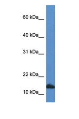 CDA / Cytidine Deaminase antibody LS-C135928 Western blot of HepG2 Cell lysate. Antibody concentration 1 ug/ml.