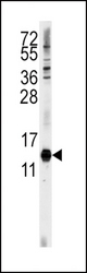 Western blot of anti-CDA Antibody in HeLa cell line lysates (35 ug/lane). CDA (arrow) was detected using the purified antibody.