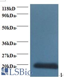Western blot of Cytidine deaminase antibody at 2 ug/ml + 293T whole cell lysate. Secondary: Goat polyclonal to Rabbit IgG at 1:15000 dilution. Predicted band size: 16.5 kDa. Observed band size: 20 kDa.
