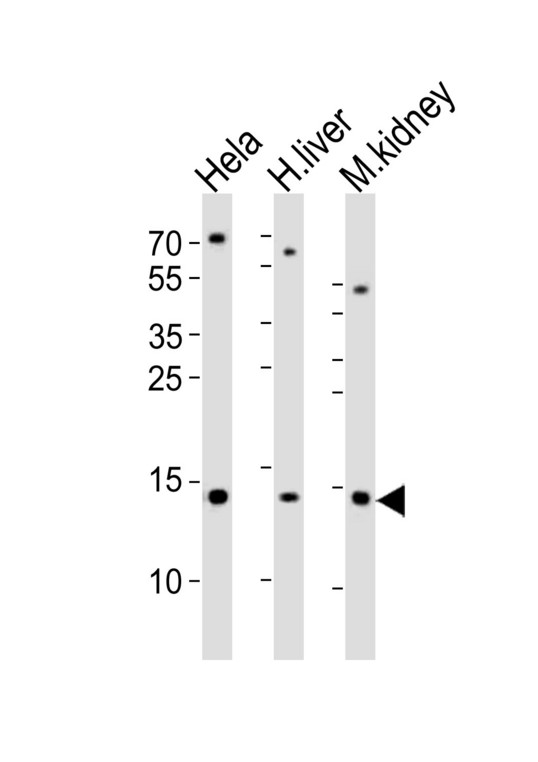 Western blot of lysates from HeLa cell line, human liver and mouse kidney tissue lysate(from left to right), using CDA Antibody. Antibody was diluted at 1:1000 at each lane. A goat anti-rabbit IgG H&L (HRP) at 1:10000 dilution was used as the secondary antibody. Lysates at 35ug per lane.