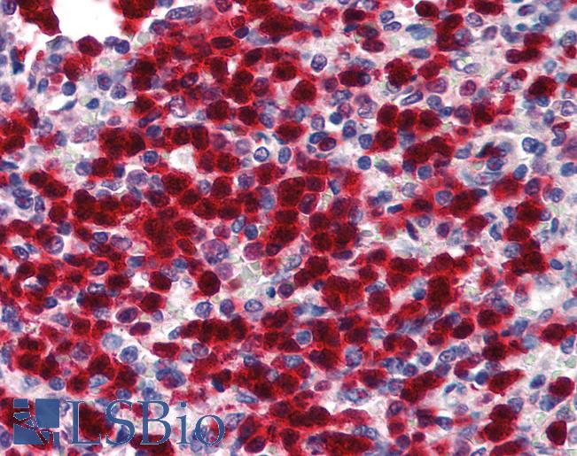 Anti-Cytidine Deaminase antibody IHC of human spleen. Immunohistochemistry of formalin-fixed, paraffin-embedded tissue after heat-induced antigen retrieval. Antibody LS-B1823 concentration 5 ug/ml.